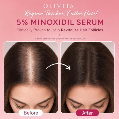 OLIVITA 5% Minoxidil Hair Regrowth Serum for Women & Men - 2 Pack, 4 Fl Oz Each