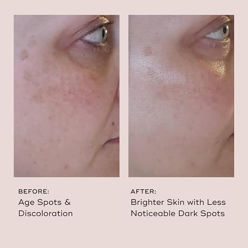 EVER Vitamin C Serum for Face 10% 0.33 oz – Dark Spot Correcting & Brightening