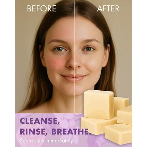 Massey¡¯s CF 100% Natural Probiotic Soap - Powerful Tea Tree and Lemon Body Soap - 4oz Lemon Scent