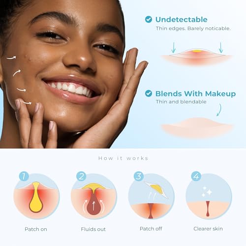 Hydrocolloid Pimple Patches (Made in Korea) FSA/HSA Eligible - Vegan, Hypoallergenic, Cruelty-Free Acne Circle Stickers for Overnight Use, for Zits, Spots, Pimples, Whiteheads (46 Count, Mixed Sizes)