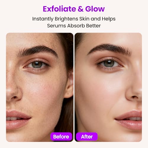 Dermaplane Razor for Women Face with 10 Replacement Blades, 3 Adjustable Speeds, Gentle & Painless Peach Fuzz Remover for Smooth Skin£¬Built-in LED Light Dermaplane Razor Eyebrow Trimmer