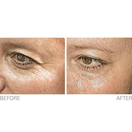 Look 10 years younger in minutes with Genesphere which moisturizes and lifts wrinkles out from below reducing the appearance of fine lines and wrinkles in under an hour