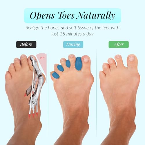 Toe Separators for Yoga & Foot Recovery ? Soft Gel Toe Spacers for Toe Splay Comfort ? Reusable, Washable ? Large, Blue, 1 Pair