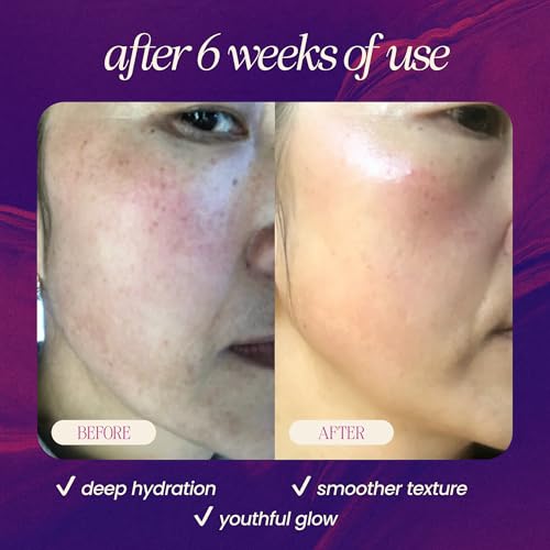 Revitalizing Pomegranate & Olive Face Cream for Wrinkles & Dark Spots - Vegan Moisturizer