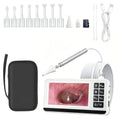 AudScope Digital Ear Otoscope with 4.5" HD Screen, 3.9mm Camera, 8 Tips & 3-Level Light