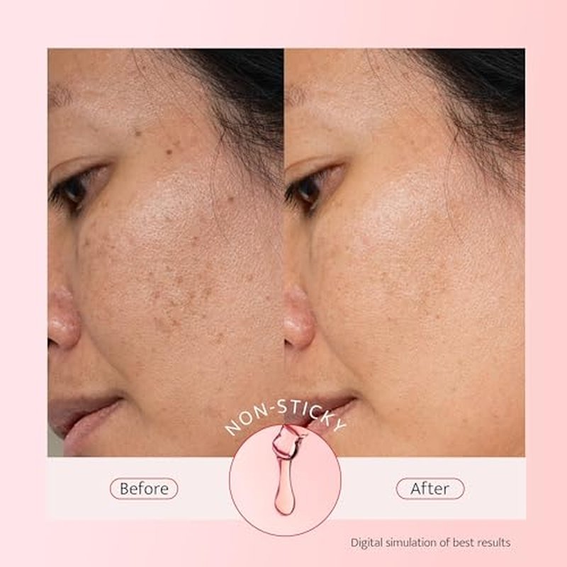10% Niacinamide + 5% Tranexamic Acid + 2% Alpha-Arbutin Dark Spot Serum with Ceramides Hyaluronic Acid Centella Asiatica - Korean Glass Skin Vegan Paraben Fragrance Cruelty Free 1 FL OZ/30mL