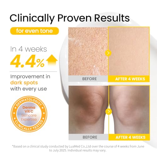 Vitamin C Body Lotion Jumbo Size - Moisturizing Korean Skincare for Dry Sensitive Skin