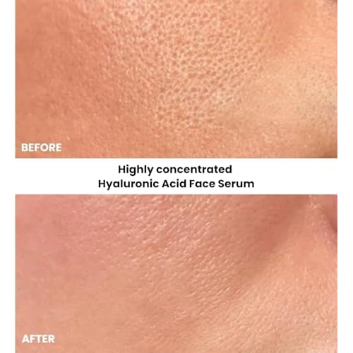 Kleem Pure Hyaluronic Acid Serum for Face with Vitamin C, Vitamin E & Green Tea | Anti Aging Hydrating Serum to Plump, Firm, Moisturize & Repair Skin | Plant-Powered Facial for Fine Lines | 1 fl oz