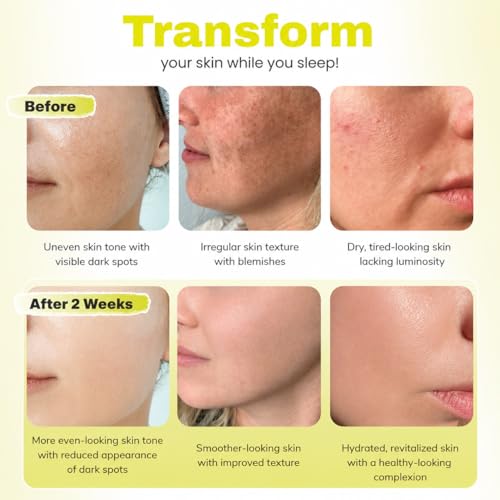 Kojic Acid Turmeric Face Mask - Hydrating Overnight Skin Care, 34ml x 5