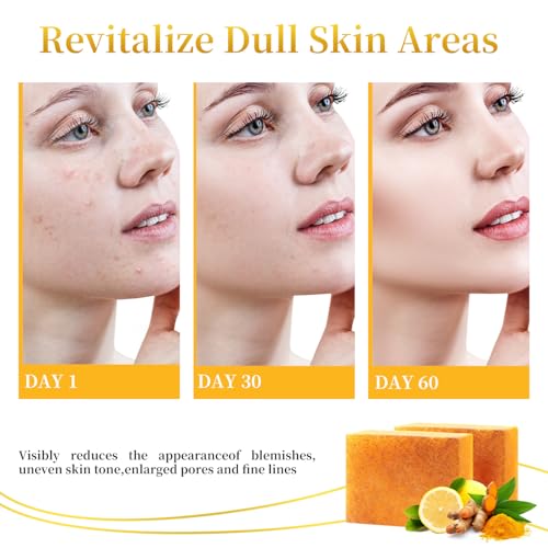 Lemon Turmeric Soap Bars for Face Body - Improve Skin Texture Turmeric Soap Bar with African Net Sponge, 4 Bars