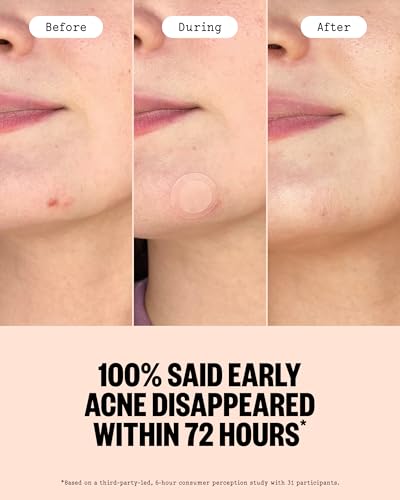 Acne Patches for Early Breakouts - Microneedling Hydrocolloid Dots, 8 Count