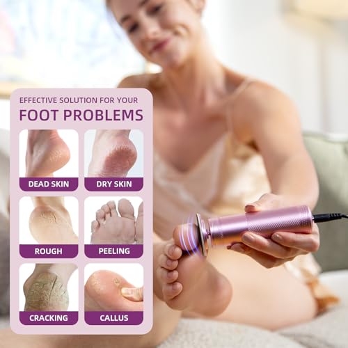 Electric Foot Callus Remover: Diamond-Coated Foot File with 3 Adjustable Speed - 60pcs Sandpaper Discs, Detachable Washable Head - Professional Pedicure Tools for Women