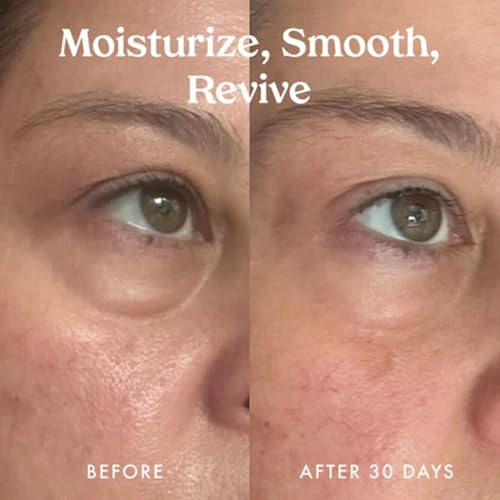 Kopari Ceramide & Retinol Dual-Core Eye Balm ? Targets Fine Lines, Texture & Puffiness with Encapsulated Retinol, Ceramides & Squalane ? Hydrating, Brightening, Anti-Aging Under Eye Treatment