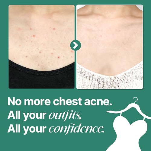 SOME BY MI AHA BHA PHA 30 Days Miracle Acne Clear Body Cleanser ? Pack of 2 ? Daily Exfoliating Tea Tree & Salicylic Acid Acne Body Wash ? Deep Cleanses Sebum, Oil & Impurities ? Korean Skin Care