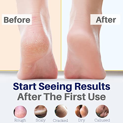 Yellow Bird Foot Cream 2 Pack - Natural Dry & Itchy Feet Repair Balm, 4 Ounce Each