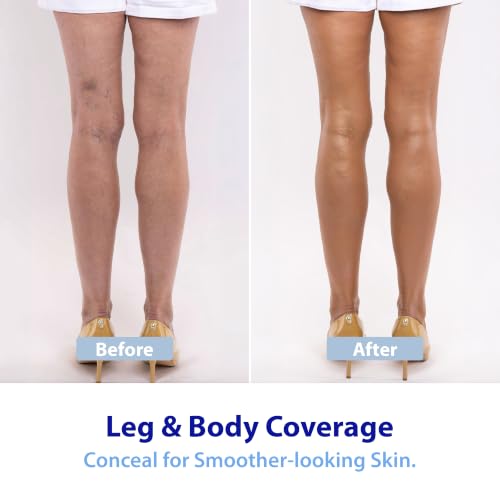 Dr. Denese Glow Younger Body Concealer Natural 3.4oz Full Coverage for Veins & Discoloration