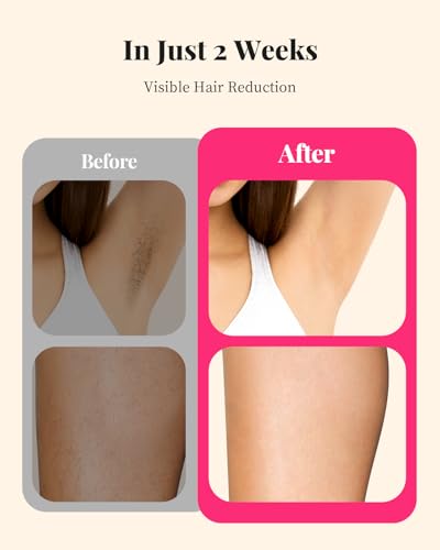 LYSMOSKI White IPL Laser Hair Removal Device for Full Body, Painless, 5.2 cm² Window
