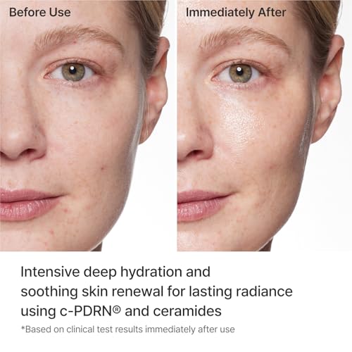 Rejuran Turnover Mask with c-PDRN® - Salmon DNA Facial Sheet Mask 5 Pack