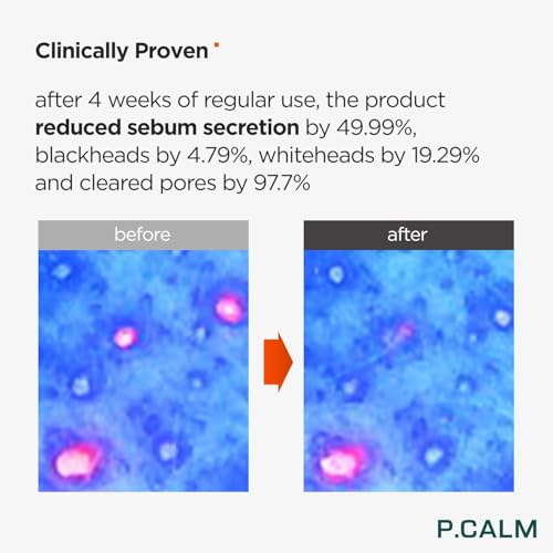 Deep Pore Cleansing Foam Cleanser with Azulene - 150ml, Vegan & Sensitive Skin