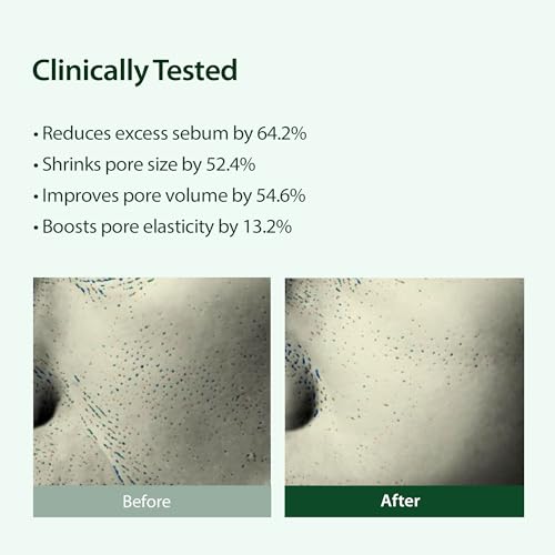 Targeted Pore Serum with 22% Niacinamide for Clear Skin - 1 fl oz