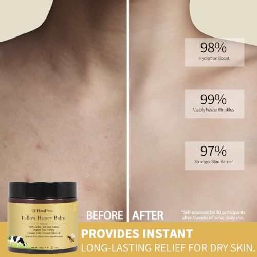 Citrus Tallow and Honey Balm - Organic Grass-Fed Beef Tallow Moisturizer with Olive Oil & Botanicals - 4.23 Fl Oz - Pack of 1