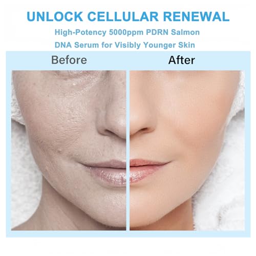 Salmon DNA Serum with Hyaluronic Acid - 30 Ampoules, 0.05 oz Each - Hydrating Anti-Aging Skincare