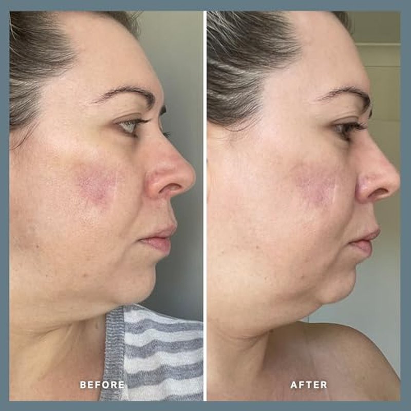 Alpha-H Vitamin A Serum With 0.5% Retinol - Gentle Night Renewal For Smoother, Brighter-Looking Complexion - Promotes Improved Texture, Elasticity, And Reduces Appearance of Visible Lines