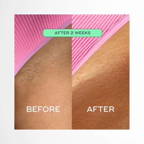 Luna Daily Ingrown Hair Oil 1 Fl Oz - Razor Bump & Redness Relief, Pack of 1