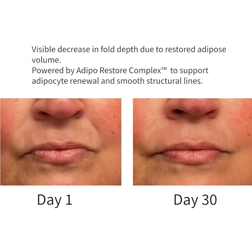 Deep Hydrating Anti-Aging Face Moisturizer with Hyaluronic Acid & Ceramides - Volume & Firmness Support, 1.7 fl oz