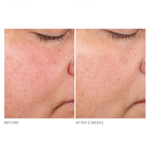 Dr. Dennis Gross Advanced Retinol + Ferulic Texture Renewal Serum ? Anti-Aging Formula to Smooth Texture, Boost Radiance, and Minimize Fine Lines & Wrinkles, 1 oz