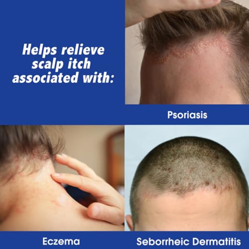 Scalpicin Max Strength Scalp Itch Treatment, 1.5 oz(Pack of 3)