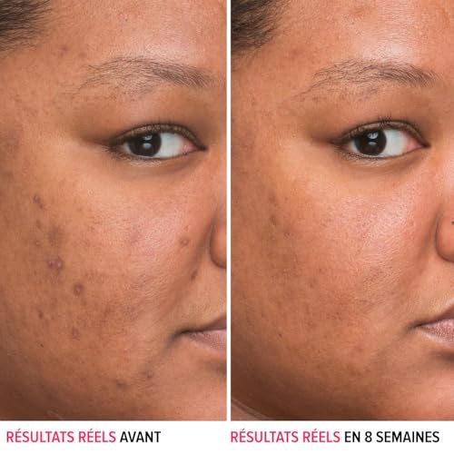 Niacinamide Face Serum for Dark Spots and Even Skin Tone 4% Niacinamide