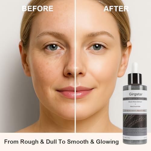 Black Rice Exfoliant Peeling Ampoule 80ml - Gentle Chemical Face & Pore Cleanser