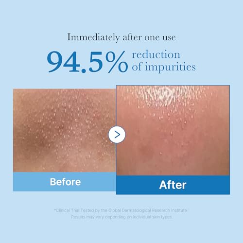medicube 3-Step Zero Pore Care Trio: Zero Pore Blackhead Cleansing Oil, Zero Pore Mud Mask, and Multi Pore Brush & Mask Applicator | All-in-One Blackhead & Excess Sebum Facial Care Routine