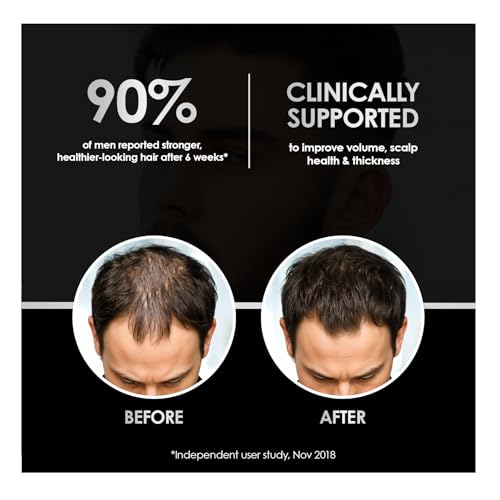 Men's Hair Growth Shampoo & Conditioner Set - Thinning Hair Care