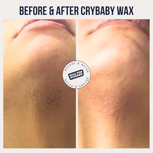 Crybaby Wax I¡¯m Sensitive Meltdown Vegan Hard Wax 6.5oz, Coconut-Infused Stripless Wax for Sensitive Skin, PCOS Facial Hair, Face, Bikini, Underarms & Body