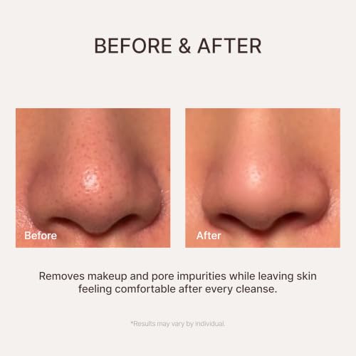 Aloe Fermentation Cleansing Oil for All Skin Types - Hydrating Makeup Remover & Blackhead Solution