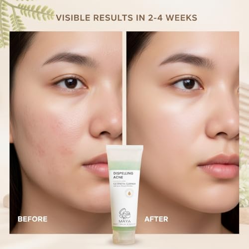 MAYA Ice Crystal Salicylic Acid Cleanser ? 2% BHA Acne Face Wash with Green Tea and Bamboo, Exfoliating Ice Scrub, Removes Dead Skin & Clears Pores ? 120 g