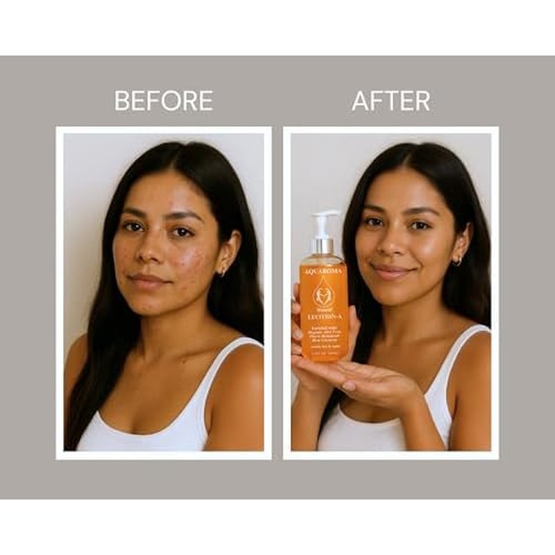 Aquaroma Natural Daily Skin Wash ? Cleanser for Sensitive, Acne & Oily Skin ? With Aloe Vera, Vitamin E, Beta Carotene & Lecithin ? Vegan, Daily Wash for Face, Body, Shaving & Scalp - 8.0 FL OZ