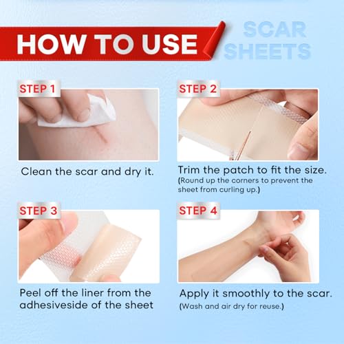 Wifamy Silicone Scar Sheets for Women: Medical Grade Scar Removal C-Section Recovery & Post-Surgery Care (1.6"X 120" Roll-3M)