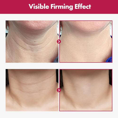 Collagen Neck Cream for Firming & Wrinkle Reduction - Korean Moisturizer