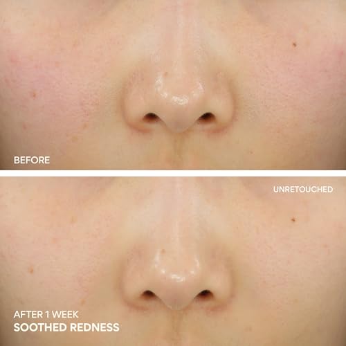innisfree Green Tea Ceramide Cream, Hydrating Rescue Cream for Dry, Sensitive, and Eczema Prone Skin