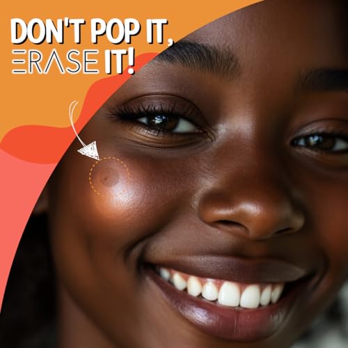 Erase Pimple Patches for Face - Fast-Acting Acne Patches with Hydrocolloid Patch Technology, 108 Patches: Parches Para Acne Invisible Design, Secure Adhesion for Proactive Acne Treatment for Face