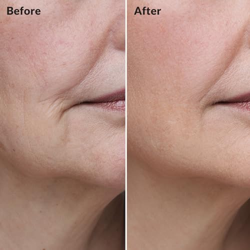 BIOCHEM Placenta Face Cream Ultra Anti-Aging Moisturizer, 1.41 oz (Placenta Variation)