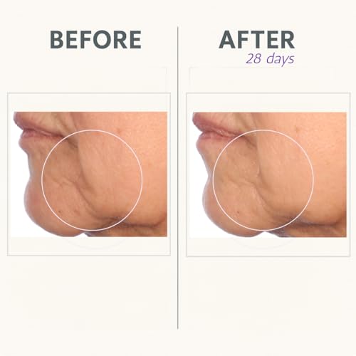 Serious Skincare Reverse CREAM IN-TENSE Firming Face Moisturizer 1.7 oz Anti-Aging