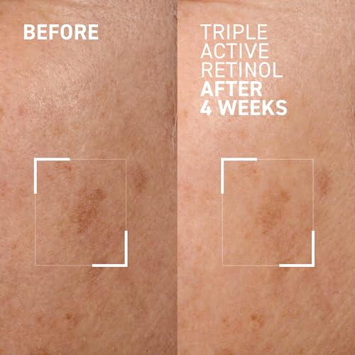 Dr. Brandt Bright This Way Triple Active Retinol Night Cream - 1 oz - Acne & Hyperpigmentation