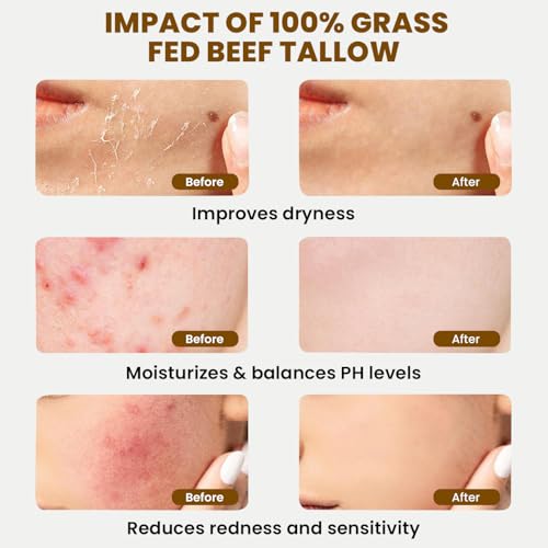 MONIER Whipped Beef Tallow for Skin, Tallow and Honey Balm for Face, Moisturizer with 100% Organic Grass-Fed Beef Tallow & Raw Wild Honey - Packaging May Vary - Dry & Sensitive Skin (Unscented)