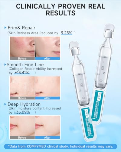Recombinant Collagen Essence 2.0 by KOMFYMED - Skin Hydration & Firmness Serum, 30 Vials