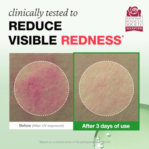 Physiogel Rosateca Redness Reducing Serum for Sensitive Skin 1.01 fl oz