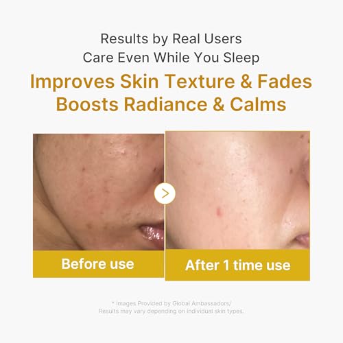 Kojic Acid Overnight Mask & Clarifying Capsule Serum Duo by Medicube